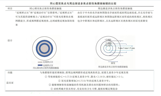多焦点软性角膜接触镜